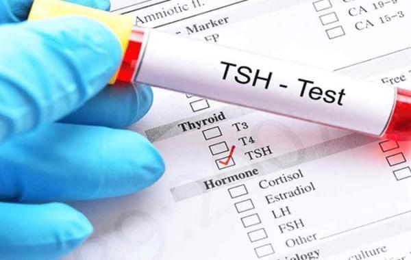 همه چیز راجع به آزمایش TSH