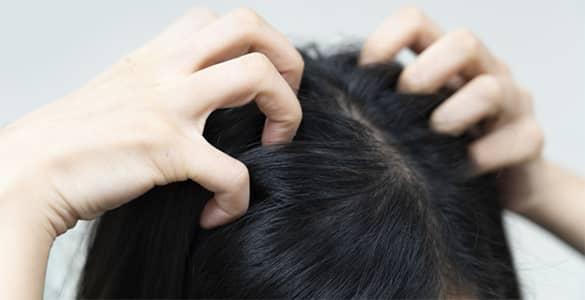 با 8 روش موثر و ساده خانگی، خشکی پوست سر را درمان کنید!